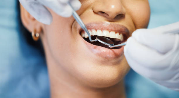 Best Emergency Dentist for Knocked-Out Tooth in Friars Point, MS