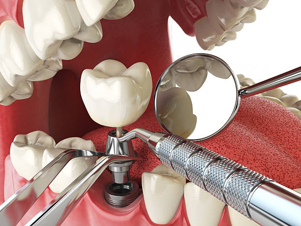 Best Broken or Cracked Tooth Emergency Dentist in Friars Point, MS